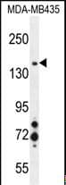 c-Met Antibody
