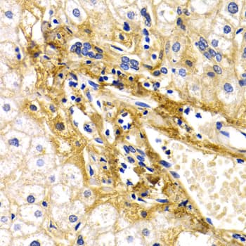 IHC-plus™ CFH / Complement Factor H Antibody