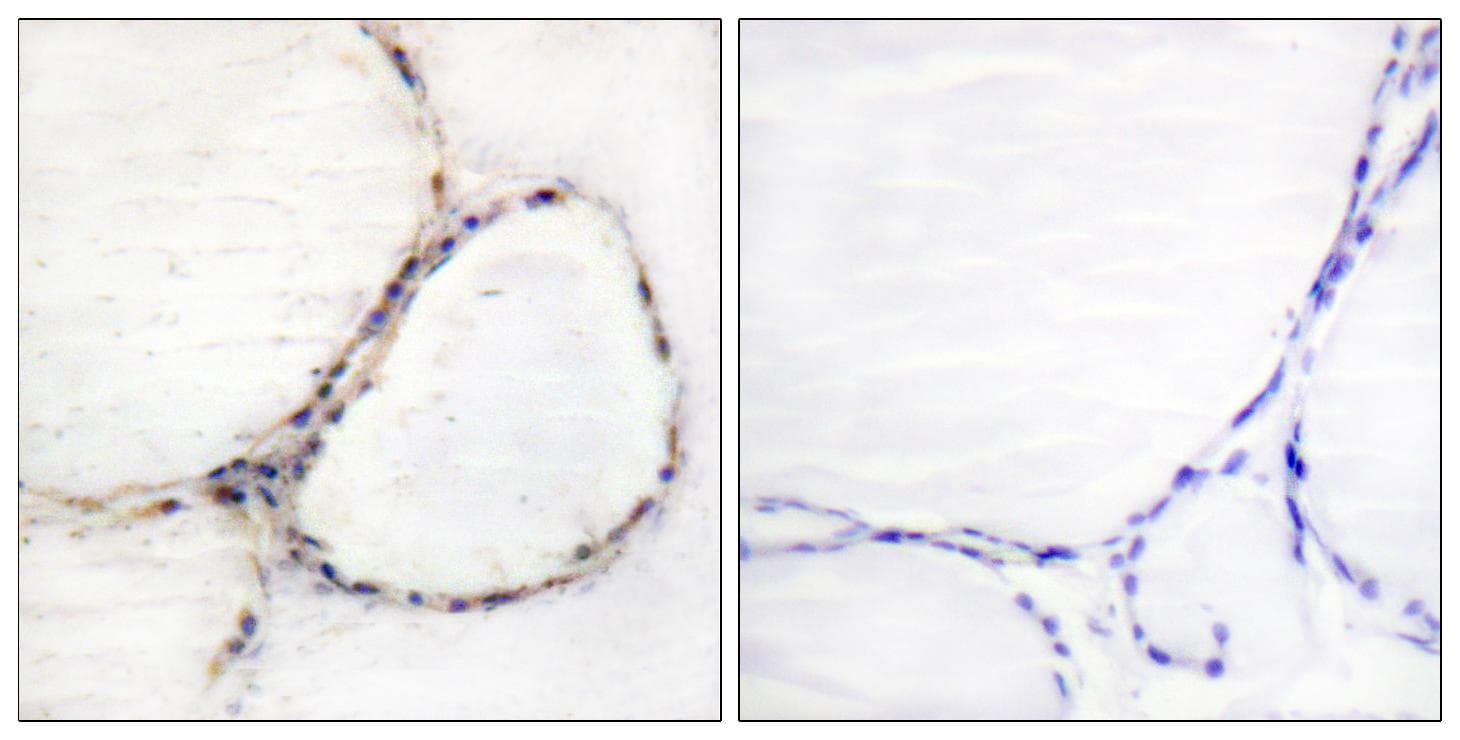 AHR Antibody (p36)