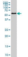 SMAD1 Antibody (clone 1C7)