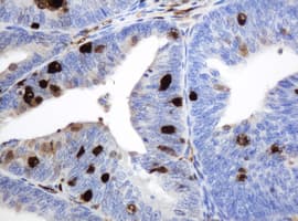 TP / Thymidine Phosphorylase Antibody (clone OTI1H7)