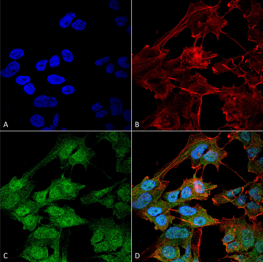 Polyclonal Rabbit anti-Human ATG9B Antibody (RPE, IF, WB)