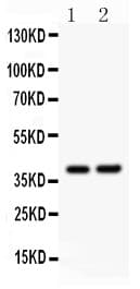 Polyclonal Rabbit anti-Human SOX1 Antibody (aa215-248, WB)