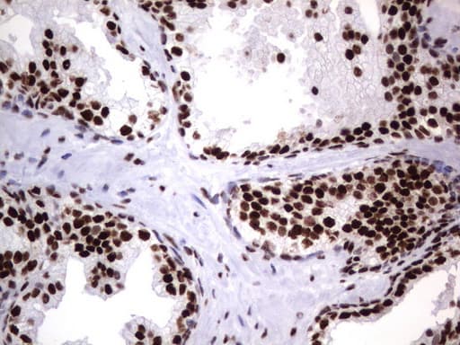 DDX56 Antibody (aa323-547, clone UMAB153)