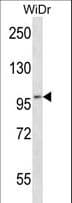 EIF4ENIF1 / 4E-T Antibody (aa80-108)