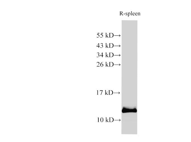 Polyclonal Rabbit anti-Rat S100A9 / MRP14 Antibody (IHC, WB)
