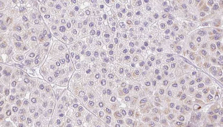 PROS1 / Protein S Antibody