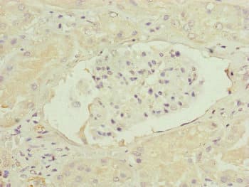 FBXO6 Antibody