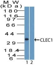 Polyclonal Rabbit anti-Human CLEC1A / CLEC-1 Antibody (aa50-100, IHC, WB)