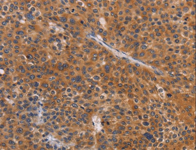NCR1 / NKP46 Antibody