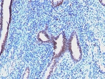 CCNB1 / Cyclin B1 Antibody (clone CCNB1/1098)