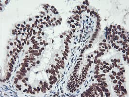 GSTT2 Antibody (clone OTI6C4)