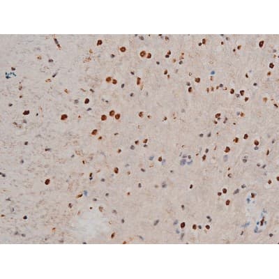 GATA1 Antibody (phospho-Ser142)