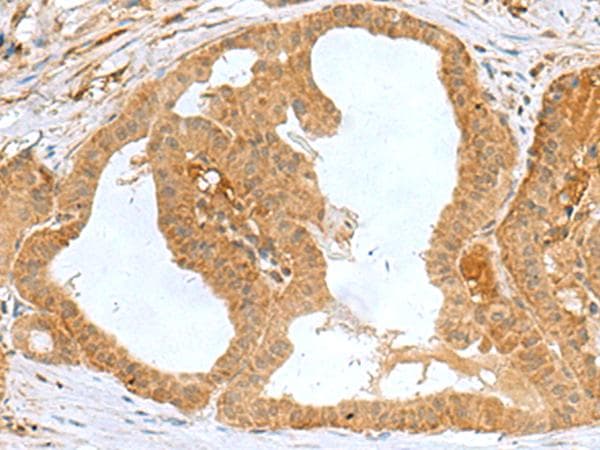 MRPS28 Antibody