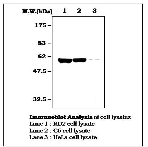 IHC-plus™ Vimentin Antibody (clone 33C7)