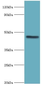 EGLN1 / PHD2 Antibody (aa301-426)