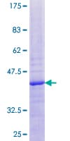 Human MRPL20 Protein (Recombinant GST)