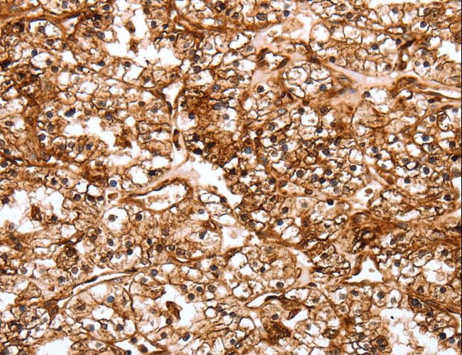 Polyclonal Rabbit anti-Human SLC9A3R2 / SIP1 Antibody (IHC)