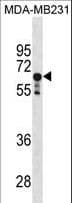PPP2R1A Antibody (aa454-481)