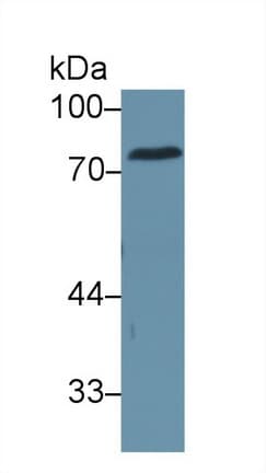 CEA / Carcinoembryonic Antigen Antibody (aa566-698)