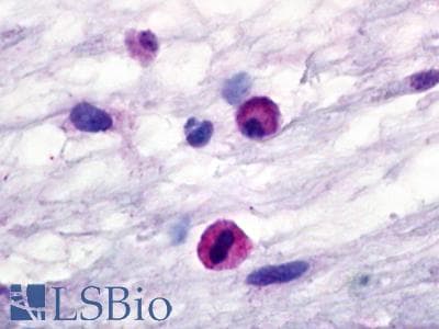 PathPlus™ C3AR / C3a Receptor Antibody (Extracellular Domain)