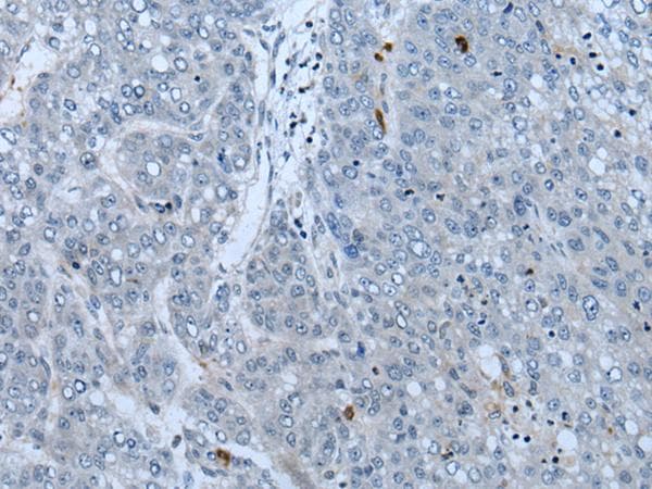 Polyclonal Rabbit anti-Human Neurofibromin / NF1 Antibody (IHC)