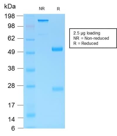 MUC6 / MUC-6 Antibody (clone MUC6/1553R)