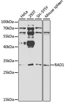 Polyclonal Rabbit anti-Human RAD1 Antibody (IHC, IF, WB)