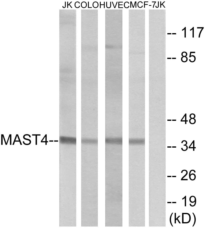 MAST4 Antibody (aa251-300)