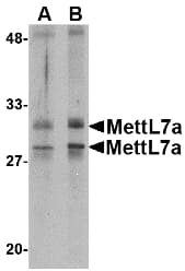 IHC-plus™ Polyclonal Rabbit anti-Human METTL7A Antibody (IHC, IF, WB)