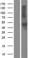 PDHA1 / PDH E1 Alpha Protein (Over-Expression Lysate Myc-DDK (Flag))
