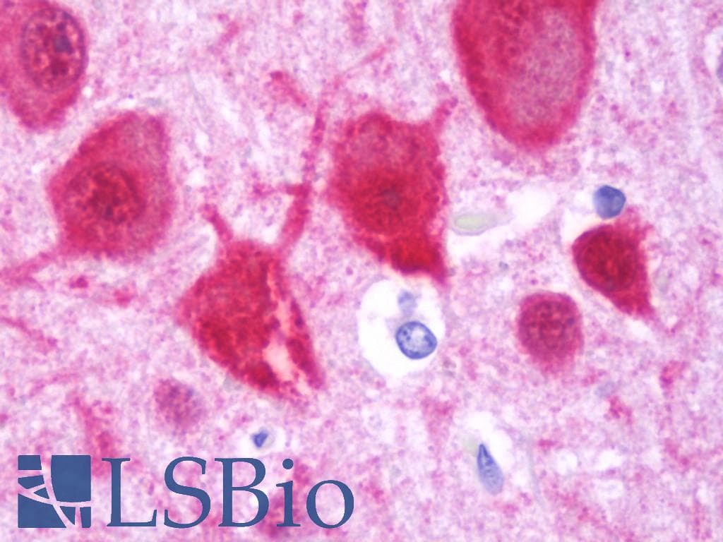 IHC-plus™ HOMER1 / Homer 1 Antibody (aa72-339)