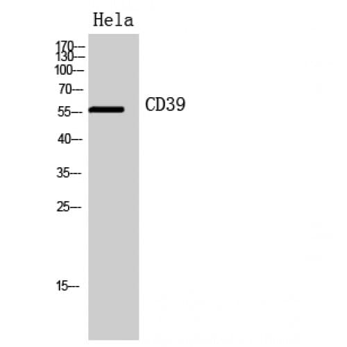 CD39 Antibody (31-80 aa, Internal)