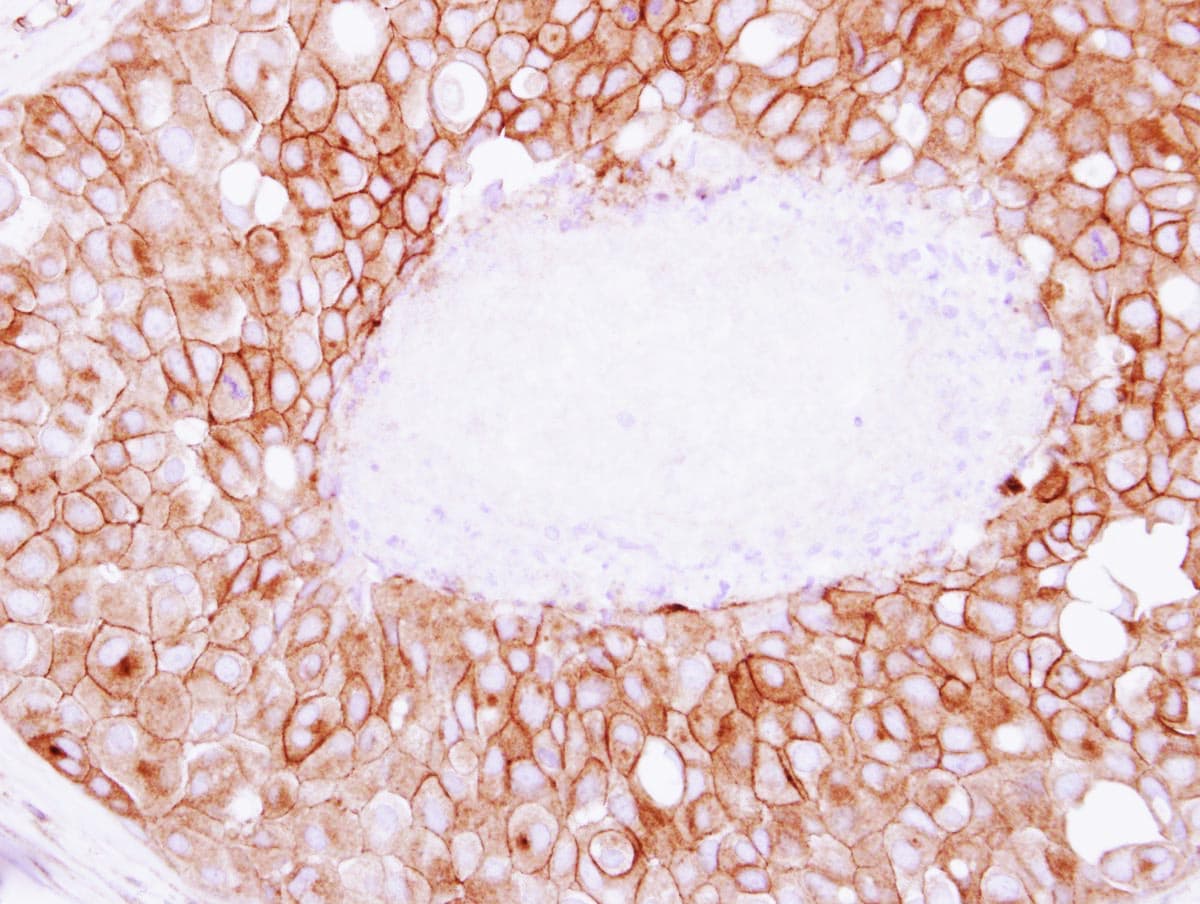 SNAP23 / SNAP-23 Antibody