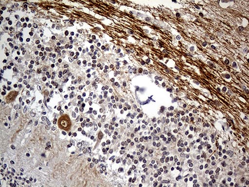Monoclonal Mouse anti-Human NEFH / NF-H Antibody (clone OTI6F11, aa778-1020, IHC, WB)