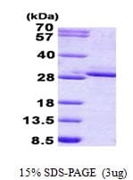 Human FGF17 Protein (Recombinant His)