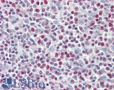IHC-plus™ Polyclonal Rabbit anti-Human RUNX3 Antibody (IHC, IF, WB)