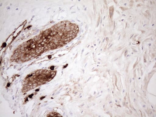 S100A9 / MRP14 Antibody (clone OTI13E12)