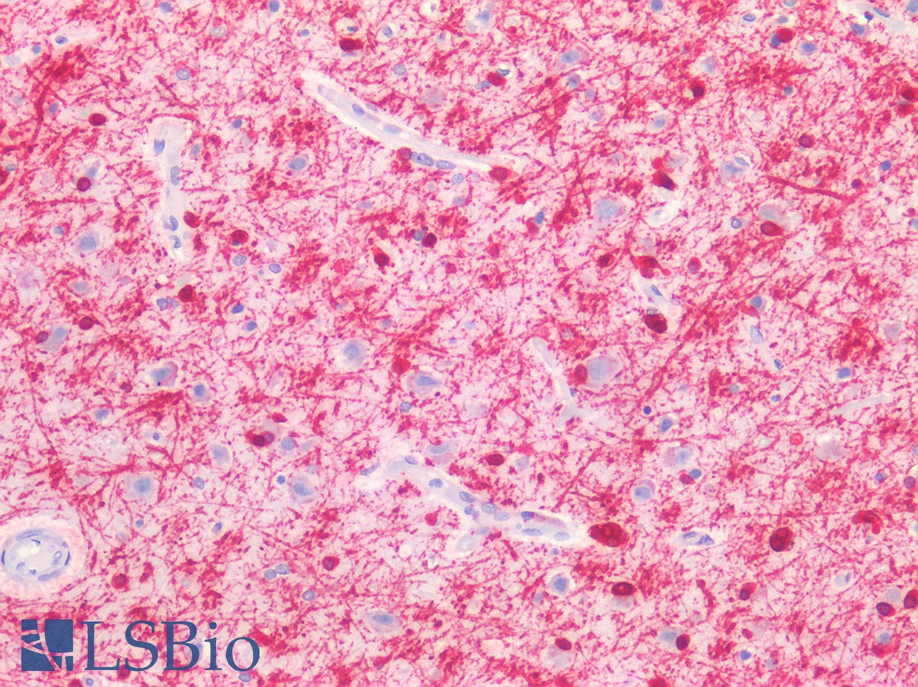 PathPlus™ MBP / Myelin Basic Protein Antibody (clone 13B511)