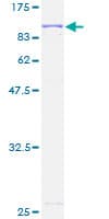 Human AK7 / Adenylate Kinase 7 Protein (Recombinant GST)