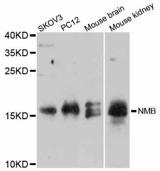 NMB / Neuromedin B Antibody