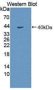 SORD / Sorbitol Dehydrogenase Antibody (aa4-344)