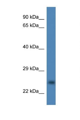 CCS Antibody (aa126-175)