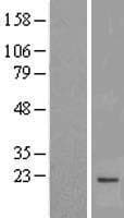 MPV17 Protein (Over-Expression Lysate Myc-DDK (Flag))