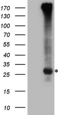 EXOSC1 / CSL4 Antibody (clone OTI4C7, Carrier-free)