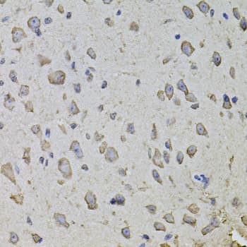 ARHGEF3 / XPLN Antibody