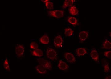 SCNN1B / ENaC Beta Antibody