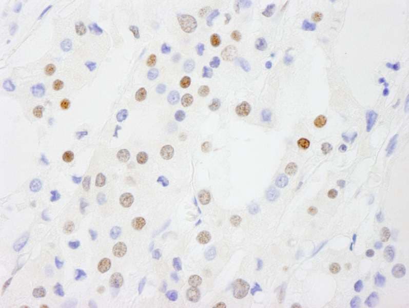 DP97 / DDX54 Antibody (aa625-675)