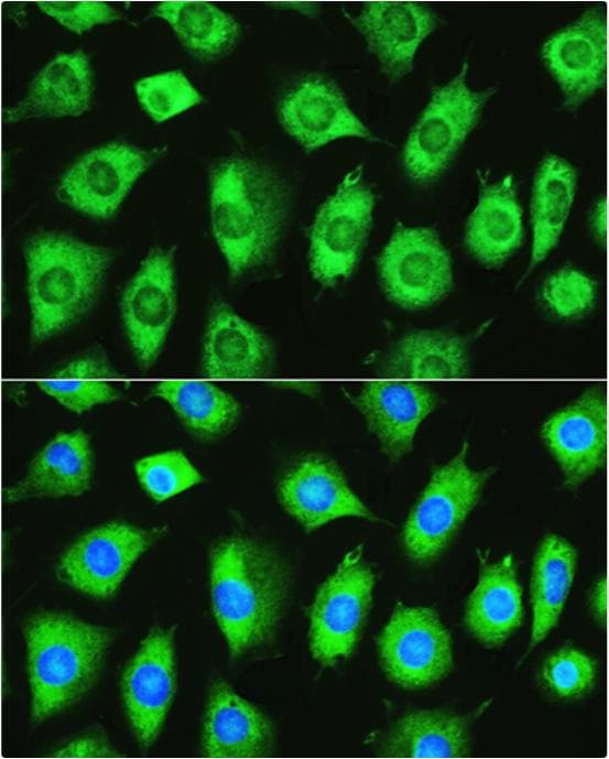 YTHDF1 Antibody