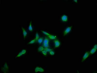 Polyclonal Rabbit anti-Human KLHL12 Antibody (IHC)